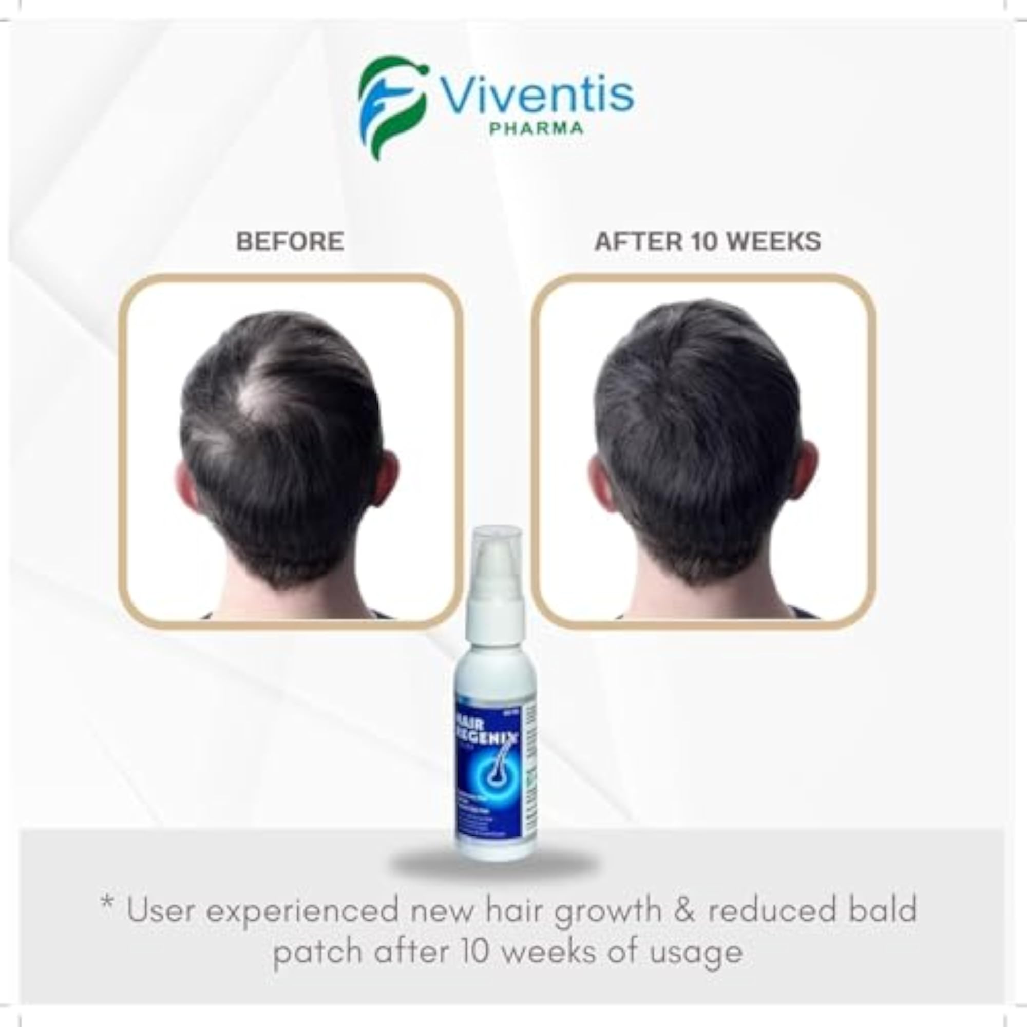 Hair Serum for Growth & Fall Control, Pack of 5